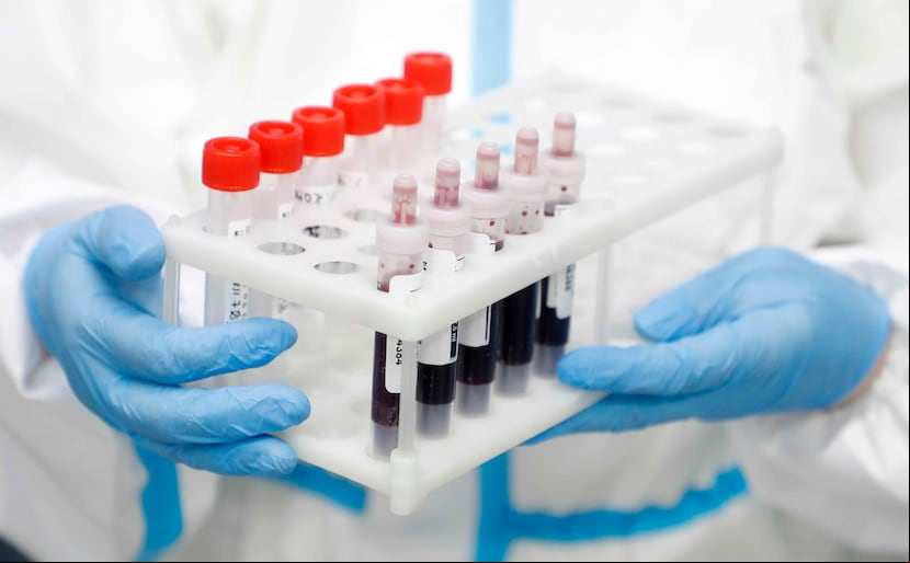 Muestras de sangre para analizar en un laboratorio en Moscú donde se realizan pruebas de COVID-19. (EFE)