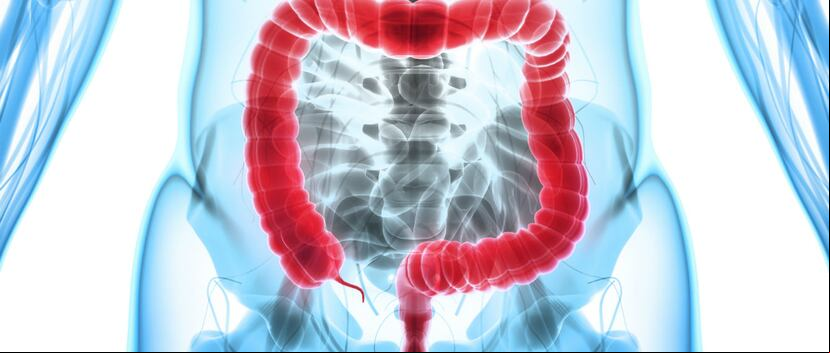 A prevenir el cáncer colorrectal